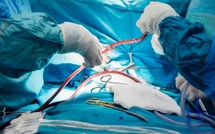 Hôpital Militaire de Rabat : nette amélioration clinique d’un patient six mois après l’implantation d’un LVAD